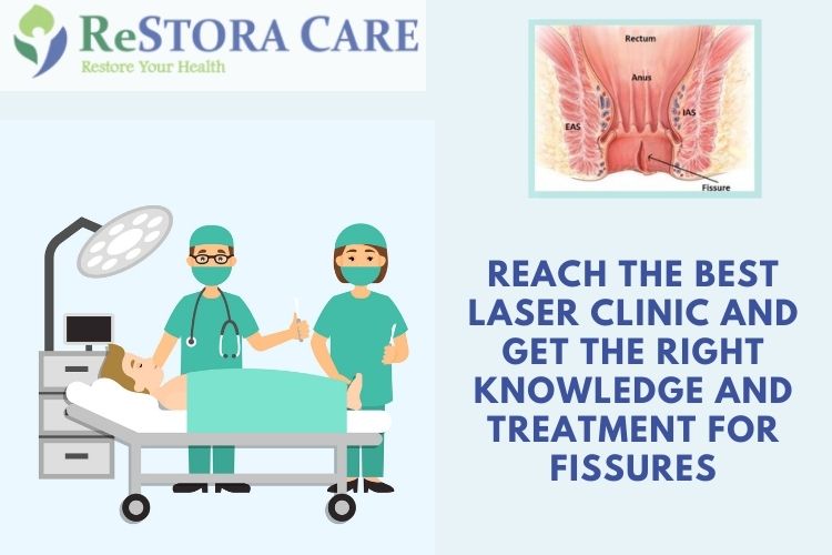 Fissure Surgery by Laser
