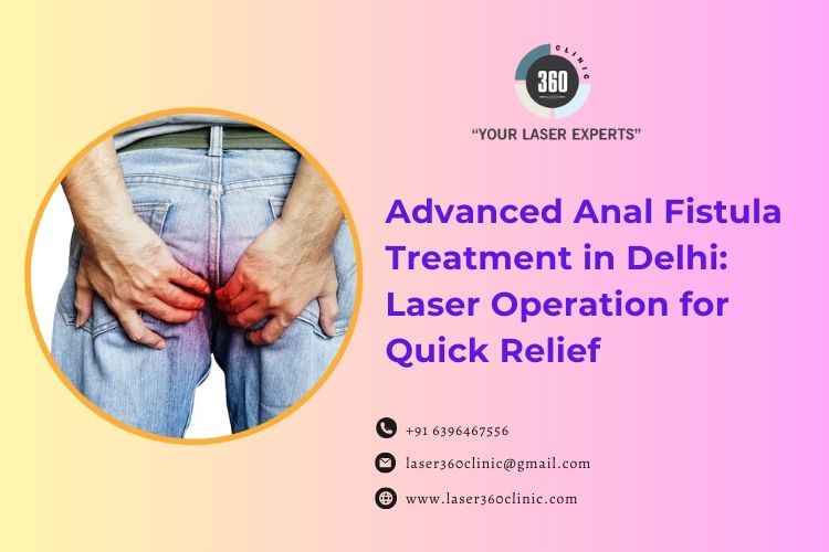 Anal Fistula Operation in Delhi