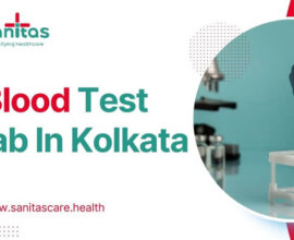 4 Things To Follow When Finding The Best Blood Test lab In Kolkata