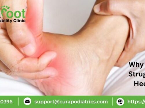 Heel Pain Reasons And Treatment